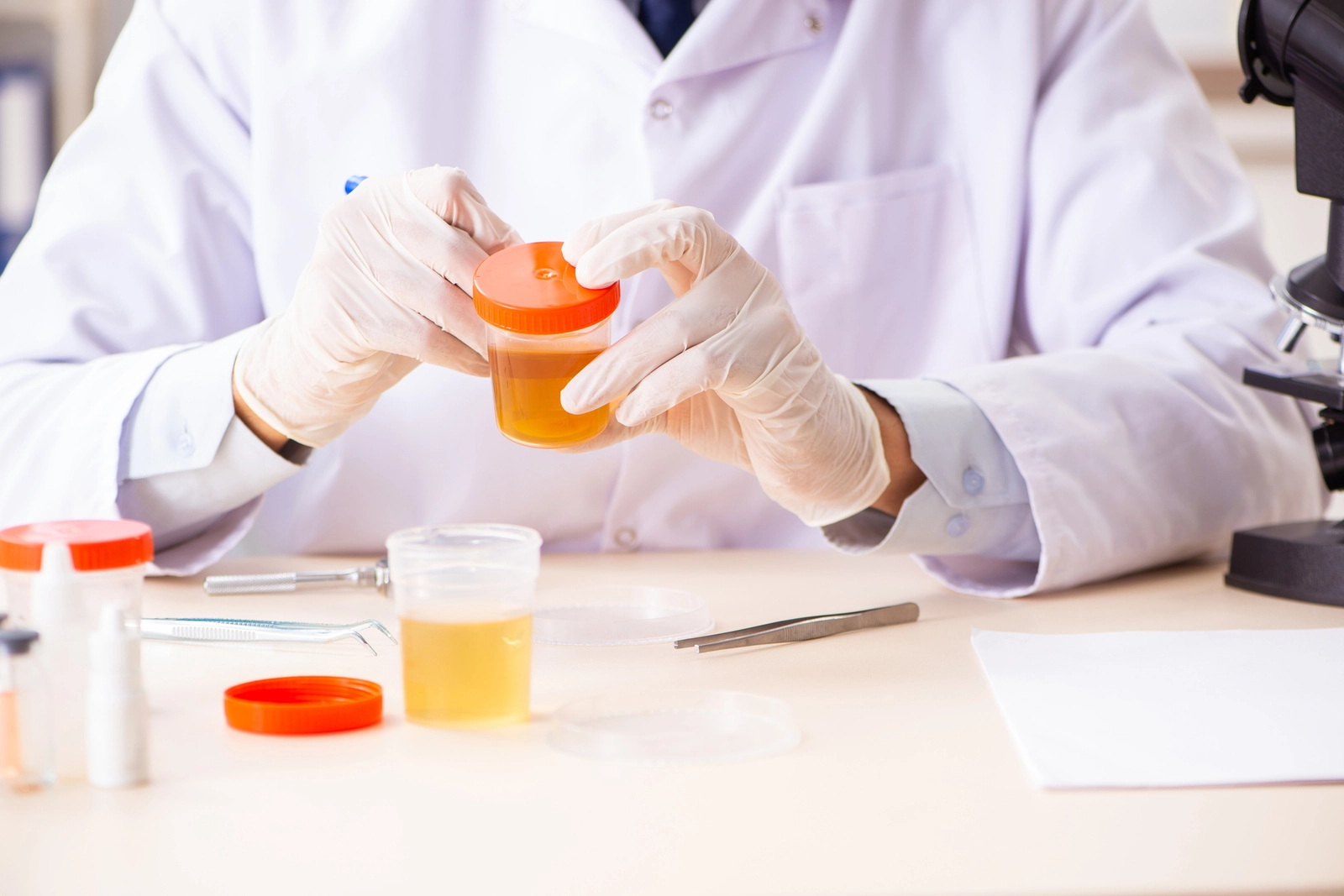 Can Suboxone Show Up On Drug Tests? A person writing on urine sample containers.